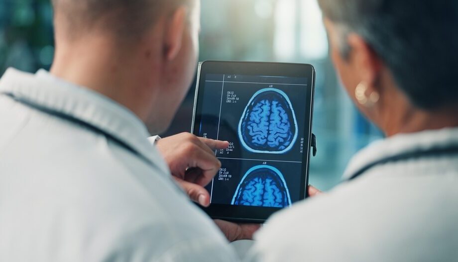 Fibrillazione atriale e salute cognitiva